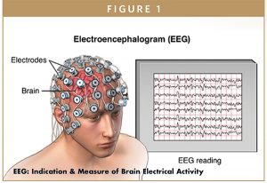 EEG: Indication & Measure of Brain Electrical Activity
