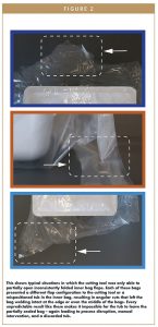 This shows typical situations in which the cutting tool was only able to partially open inconsistently folded inner bag flaps. Each of these bags presented a different flap configuration to the cutting tool or a mispositioned tub in the inner bag, resulting in angular cuts that left the bag welding intact at the edge or even the middle of the bags. Every unpredictable result like these makes it impossible for the tub to leave the partially sealed bag – again leading to process disruption, manual intervention, and a discarded tub.