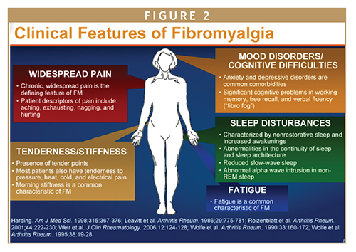 Fibromyalgia and Electric Shock Pain: Paresthesia